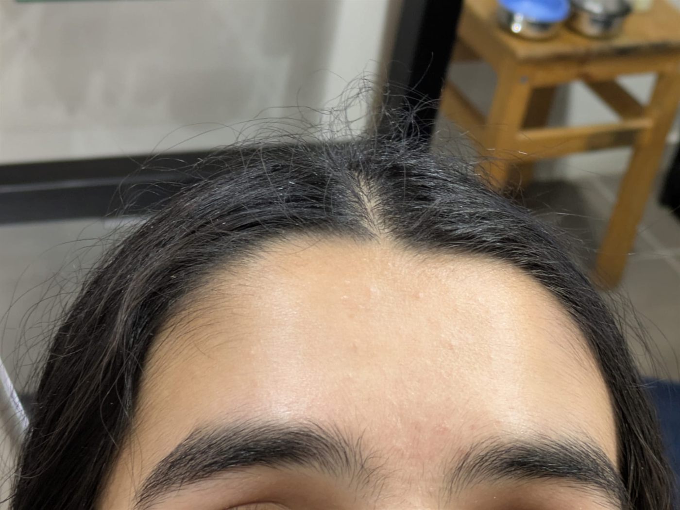 Eyebrows before threading at Drashti Beauty Salon, grown out with stray hairs above the brow line and fine hair across the forehead.